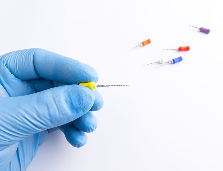 八千代緑が丘駅より徒歩1分の歯医者、公園都市プラザわかば歯科の根管治療