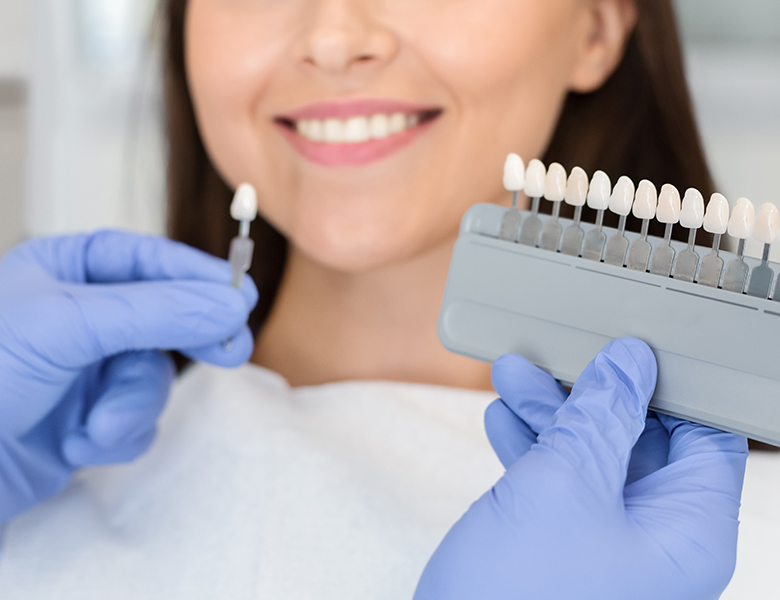 八千代緑が丘駅より徒歩1分の歯医者、公園都市プラザわかば歯科のホワイトニング