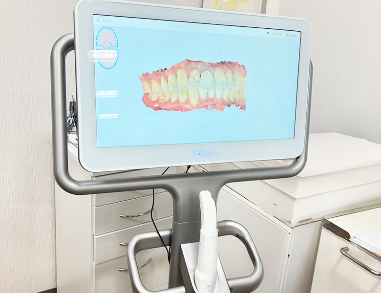 八千代緑が丘駅より徒歩1分の歯医者、公園都市プラザわかば歯科のアイテロ（itero）