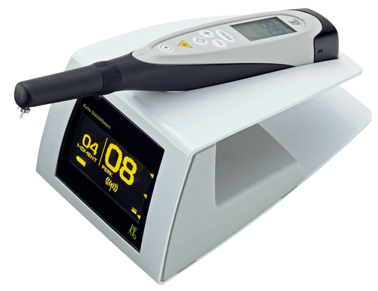  八千代緑が丘駅より徒歩1分の歯医者、公園都市プラザわかば歯科のむし歯治療