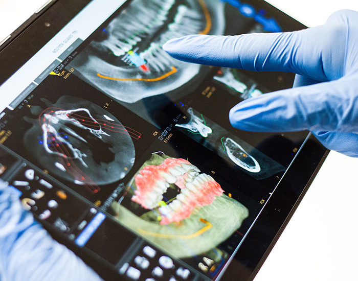 八千代緑が丘駅より徒歩1分の歯医者、公園都市プラザわかば歯科のインプラント治療