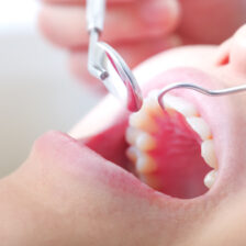 八千代市（八千代緑が丘）の歯医者、公園都市プラザわかば歯科で、エアフローって何？歯石は取れる？今までのクリーニングとの違いについて解説