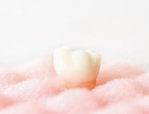 八千代市（八千代緑が丘）の歯医者、公園都市プラザわかば歯科で、むし歯になりやすい人、歯周病になりやすい人。その境界線と「自分に合った予防法」の正解について解説