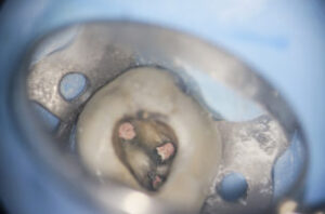 八千代市(八千代緑が丘)の歯医者、公園都市プラザわかば歯科で、なぜ歯の根の治療は長引くのか?半年以上終わらない「痛み」と「通院」を終わらせる精密根管治療について解説