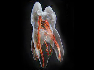 八千代市（八千代緑が丘）の歯医者、公園都市プラザわかば歯科で、なぜ歯の根の治療は長引くのか？半年以上終わらない「痛み」と「通院」を終わらせる精密根管治療について解説